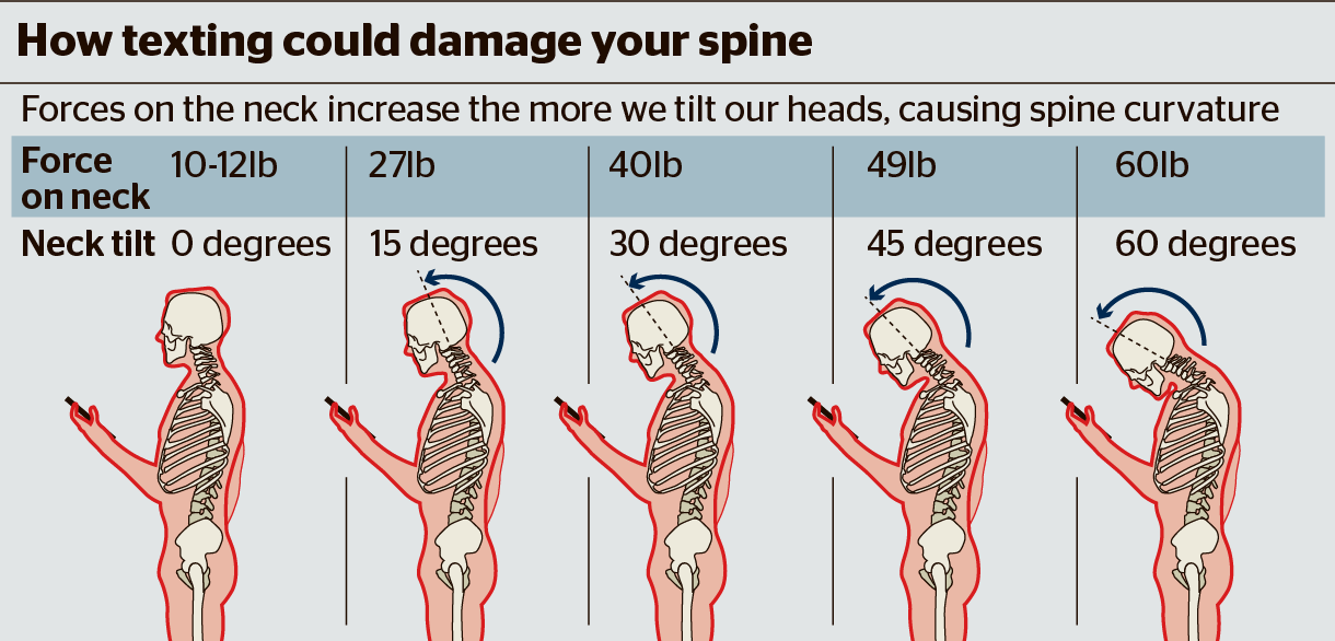 Text Neck Over Time