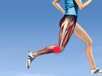 Runner's Knee