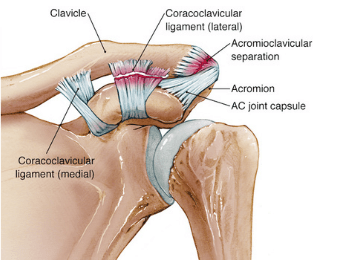 AC Joint Injury