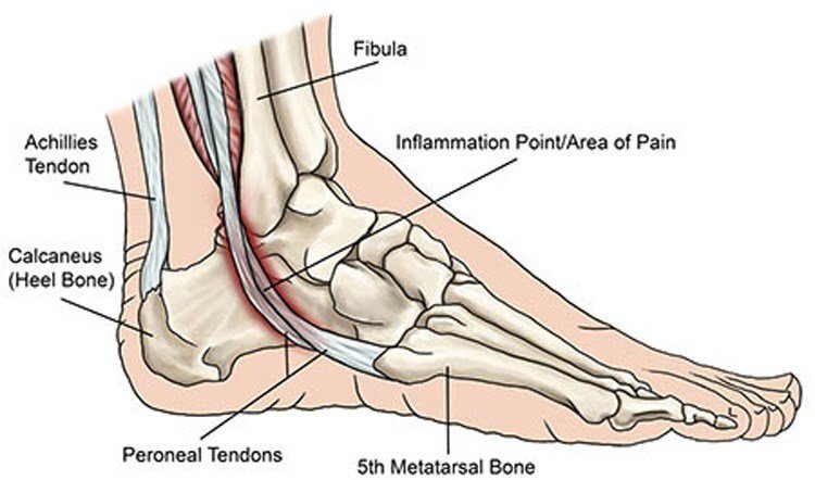 Ankle Muscle Tendinopathies