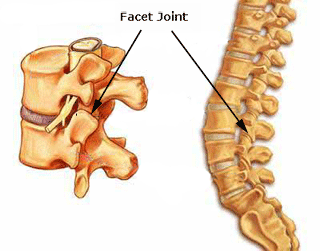 Thoracic Facet Joint Sprain