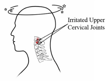 Cervicogenic Dizziness