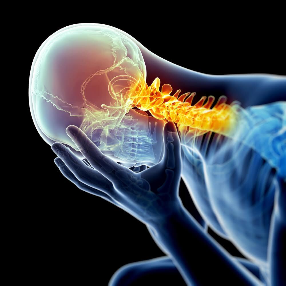Cervicogenic headache