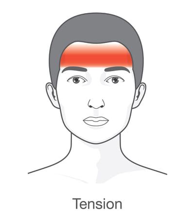 Tension Headaches